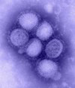 H1N1 virus