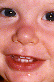 picture title